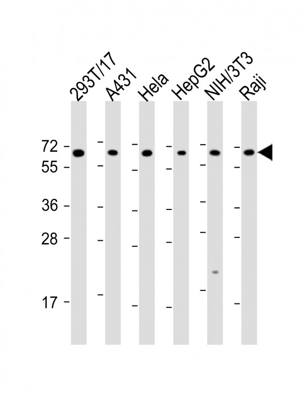 WB - SNW1 Antibody (C-Term) AP21848b